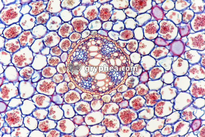 Racine de Ficaire - Cylindre central - parenchyme tubérisé CT x10 - gryphea.com